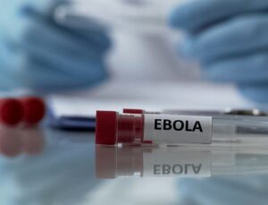 Gana’da Ebola vakası tespit edildi
