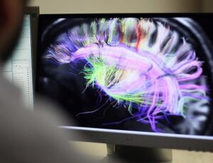 Bilim insanlarından kronik ağrıların beyindeki kaynağını inceleyen çalışma: Hastalara umut olabilir